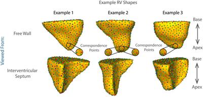 All Roads Lead to Rome: Diverse Etiologies of Tricuspid Regurgitation Create a Predictable Constellation of Right Ventricular Shape Changes